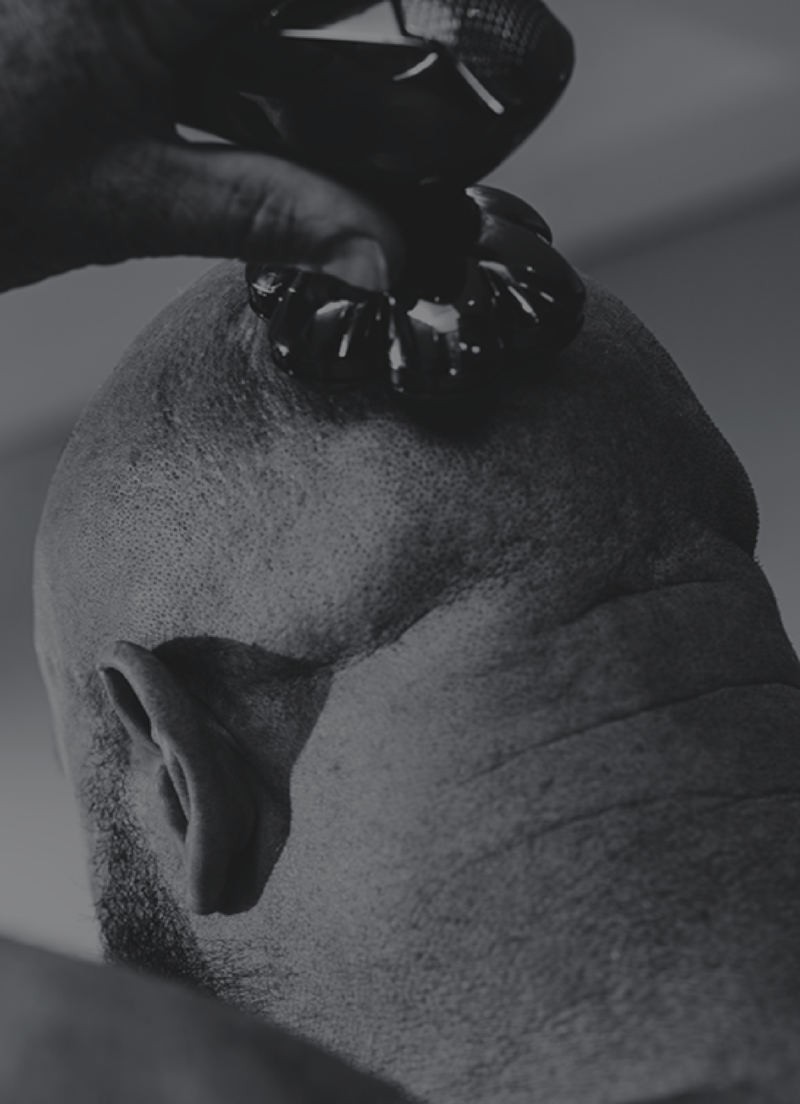 HEAD
